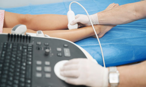 Medical specialist performing doppler ultrasound of the lower limb vessels Doctor specialist checking the veins in the patient legs with an ultrasound machine